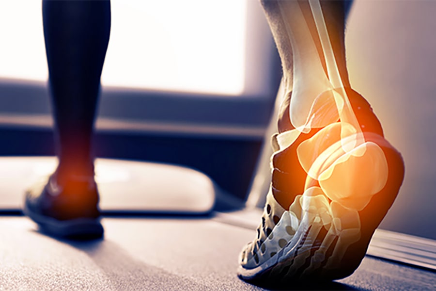 foot on treadmill showing skeletal bones